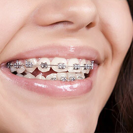 Ортодонтия