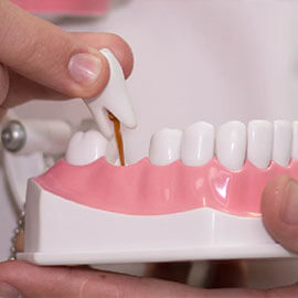 Протезирование зубов